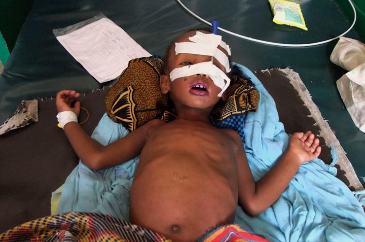 голод в Сомали, голодающее население, женщины и дети, гражданская война, экономический кризис, уникальные и шокирующие кадры голода