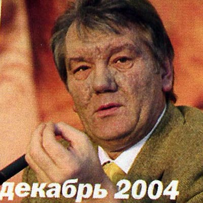 что случилось с лицом Ющенко? Чем заболел Ющенко? Лицо Ющенко до и после
